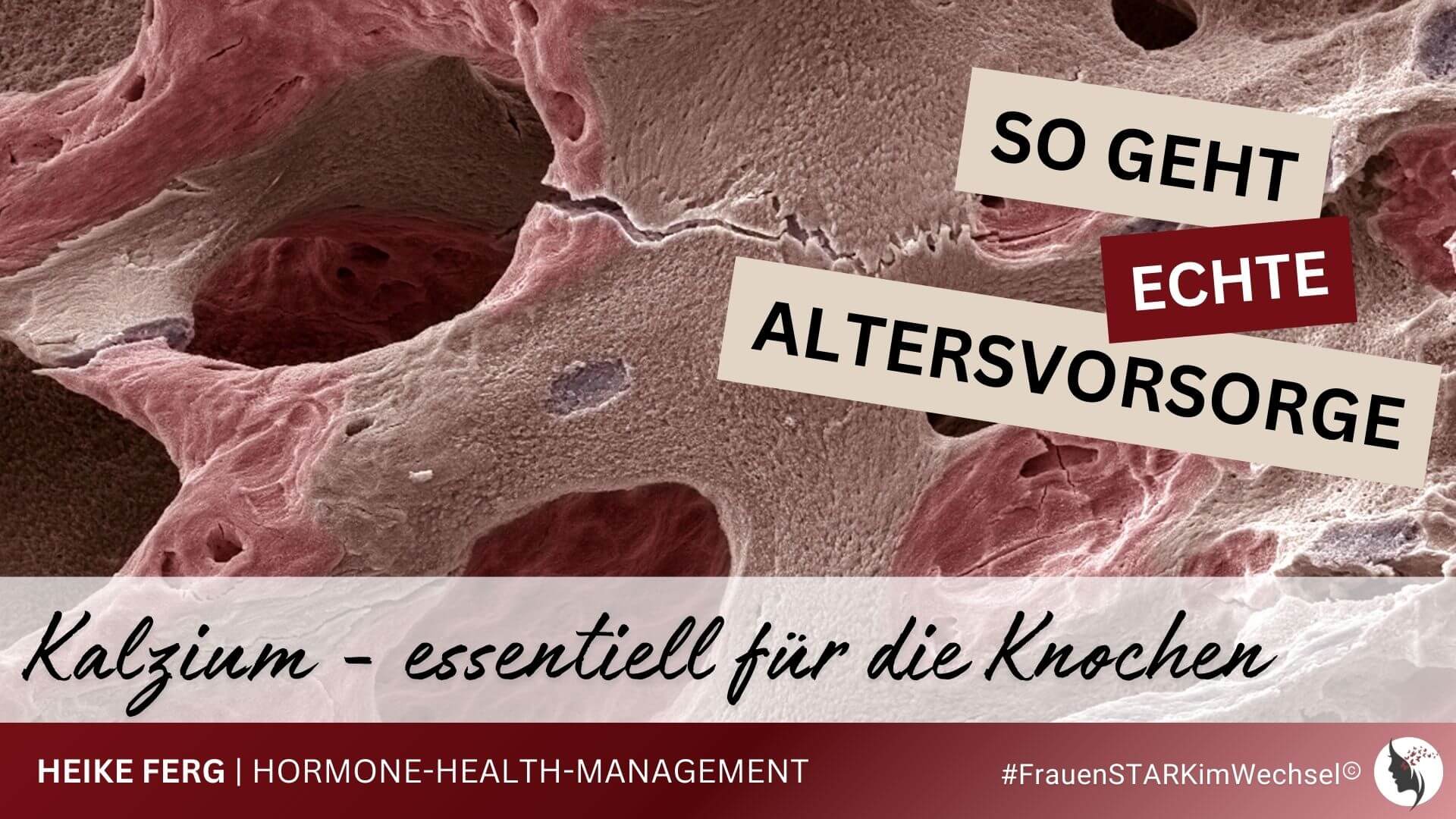 Mehr über den Artikel erfahren Osteoporose vorbeugen und Knochengerüst stärken